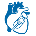 CRT-P/D implantation