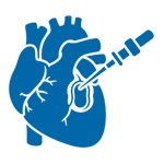 Endomyocardial biopsy