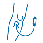 Peripheral Angiography