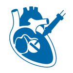 Percutaneous transluminal septal myocardial ablation