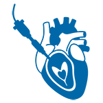 Transcatheter mitral valve replacement